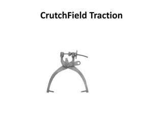 CrutchField Traction
 