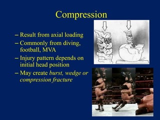 Cervical spine injury antomy and management.pptx