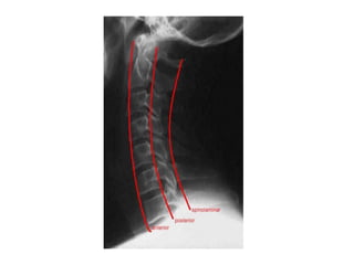 Stuart Sign Cervical Cervical Spine Injury, made simple from A to Z | PDF