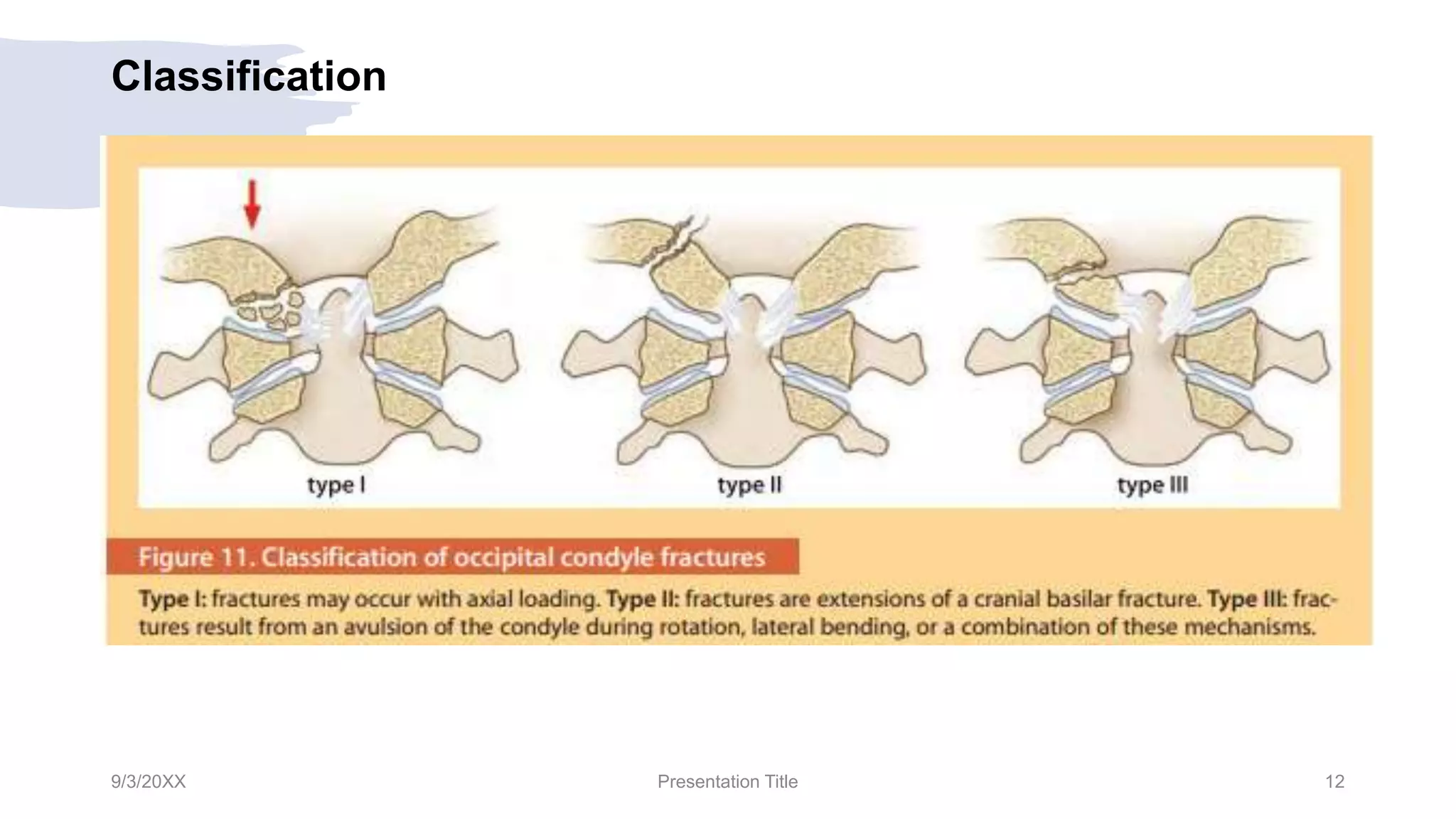 Cervical Spine Injury.pptx