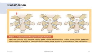 Classification
9/3/20XX Presentation Title 12
 
