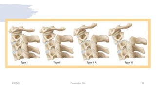 9/3/20XX Presentation Title 32
 
