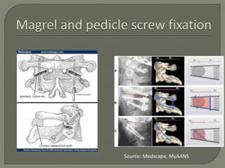 Cervical spinepathology | PPTX