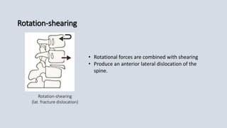 Shear Sense Rotation Cervical spine trauma | PPTX