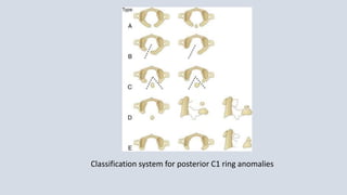 Cervical spine trauma | PPTX