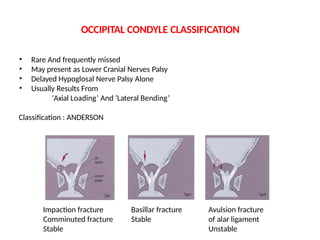 Tuli Classification Cervical spine injuries - Upper nd Lower | PPTX