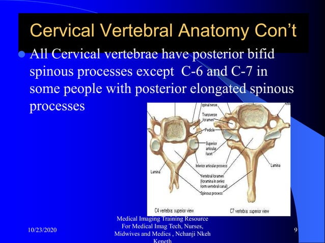 Cd Spine Example Cervical spine x ray and pathologies radiology training resource ...