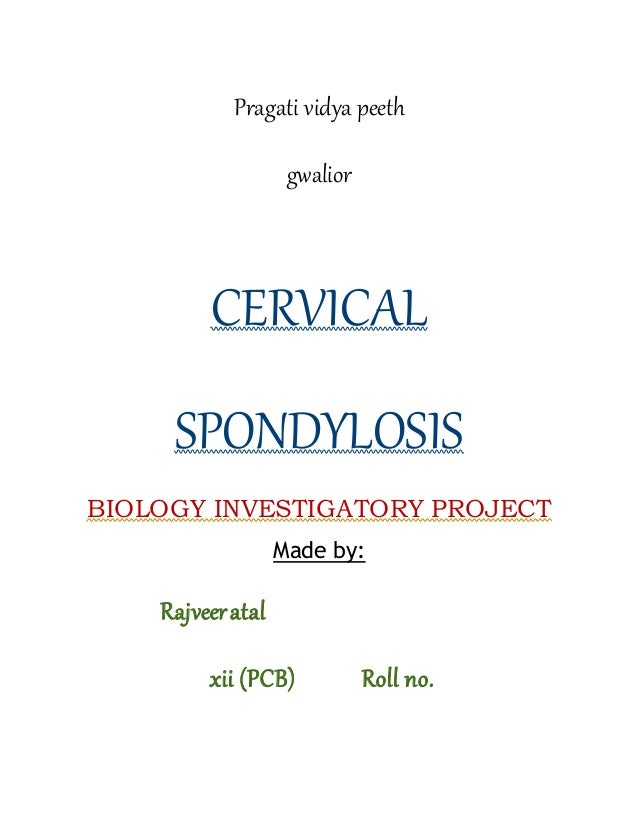 Cervical Spondylosis Exercise Chart