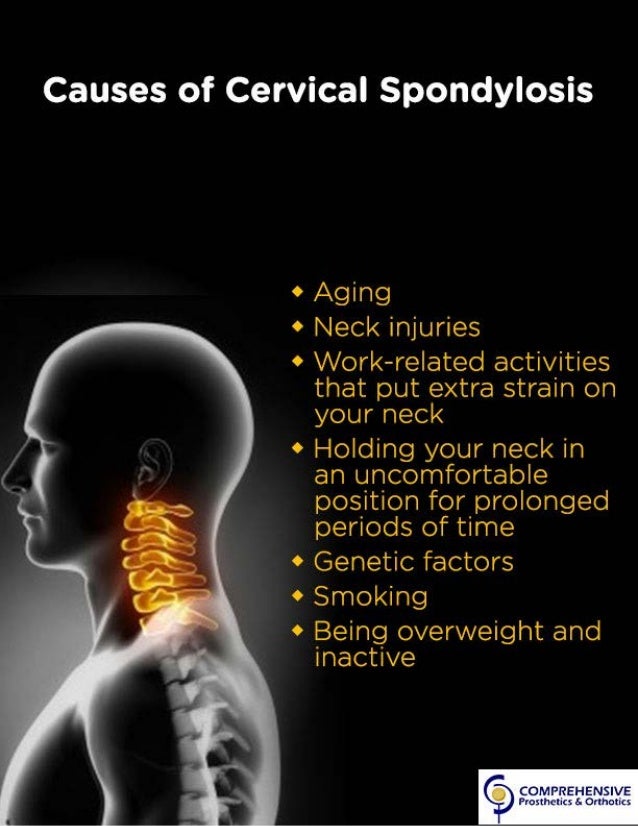 Cervical Spondylosis