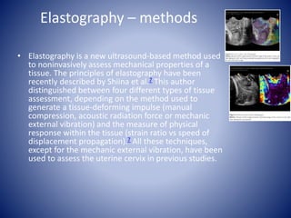 Elastography – methods
• Elastography is a new ultrasound-based method used
to noninvasively assess mechanical properties of a
tissue. The principles of elastography have been
recently described by Shiina et al.7 This author
distinguished between four different types of tissue
assessment, depending on the method used to
generate a tissue-deforming impulse (manual
compression, acoustic radiation force or mechanic
external vibration) and the measure of physical
response within the tissue (strain ratio vs speed of
displacement propagation).7 All these techniques,
except for the mechanic external vibration, have been
used to assess the uterine cervix in previous studies.
 
