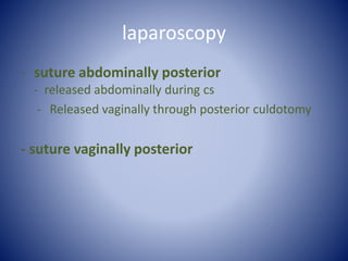laparoscopy
- suture abdominally posterior
- released abdominally during cs
- Released vaginally through posterior culdotomy
- suture vaginally posterior
 