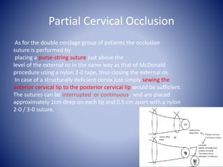 Partial Cervical Occlusion
As for the double cerclage group of patients the occlusion
suture is performed by
placing a purse-string suture just above the
level of the external os in the same way as that of McDonald
procedure using a nylon 2-0 tape, thus closing the external os.
In case of a structurally deficient cervix just simply sewing the
anterior cervical lip to the posterior cervical lip would be sufficient.
The sutures can be interrupted or continuous, and are placed
approximately 1cm deep on each lip and 0.5 cm apart with a nylon
2-0 / 3-0 suture.
 