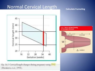 Normal Cervical Length Calculate Funneling
 
