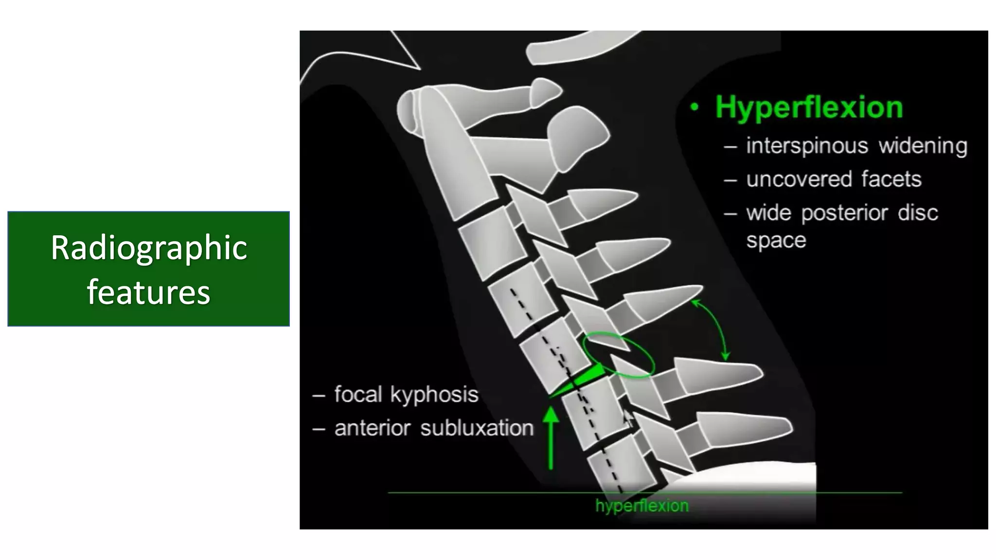 Cervical vertebrae anatomy and pathology | PPTX