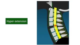 Cervical vertebrae anatomy and pathology