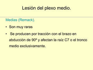 Lesión del plexo medio. Medias (Remack).  Son muy raras Se producen por tracción con el brazo en abducción de 90º y afectan la raíz C7 o el tronco medio exclusivamente. 