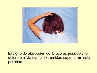 El signo de abducción del brazo es positivo si el dolor se alivia con la extremidad superior en esta posición. 