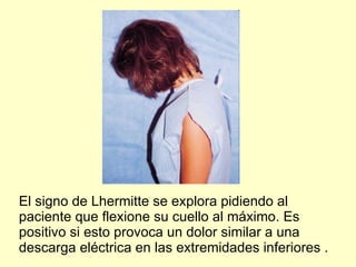 El signo de Lhermitte se explora pidiendo al paciente que flexione su cuello al máximo. Es positivo si esto provoca un dolor similar a una descarga eléctrica en las extremidades inferiores . 