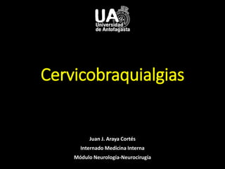 Cervicobraquialgias
Juan J. Araya Cortés
Internado Medicina Interna
Módulo Neurología-Neurocirugía
 