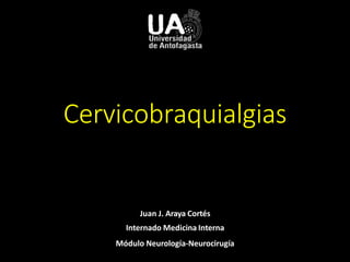 Cervicobraquialgias
Juan J. Araya Cortés
Internado Medicina Interna
Módulo Neurología-Neurocirugía
 
