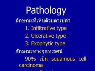 Pathology  <ul><li>ลักษณะที่เห็นด้วยตาเปล่า   </li></ul><ul><li>1. Infiltrative type </li></ul><ul><li>2. Ulcerative type ...