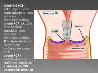 Oriģinālā PCP:
sākotnējā robeža
starp daudzkārtaino
plakano un
cilindrisko epitēliju
Jaunā PCP: aktuālā
robeža starp
daudzkārtaino
plakano un
cilindrisko epitēliju
TZ ir dzemdes kakla
rajons starp
oriģinālo un jauno
PCP
Jaunā PCP ir
visaktīvākā šūnu
dalīšanās, tāpēc tur
ir vislielākais CIN
veidošanās risks TZā
 