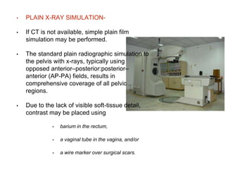 Simulator Radiograph Cervical carcinoma | PPTX