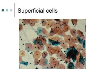 Superficial cells
 