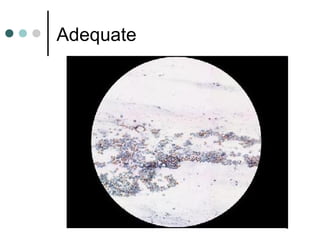 Adequate
 