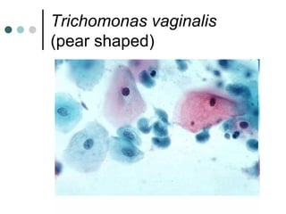 Trichomonas vaginalis
(pear shaped)
 