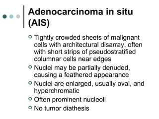 Adenocarcinoma in situ
(AIS)
 Tightly crowded sheets of malignant
cells with architectural disarray, often
with short strips of pseudostratified
columnar cells near edges
 Nuclei may be partially denuded,
causing a feathered appearance
 Nuclei are enlarged, usually oval, and
hyperchromatic
 Often prominent nucleoli
 No tumor diathesis
 