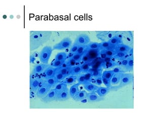 Parabasal cells
 