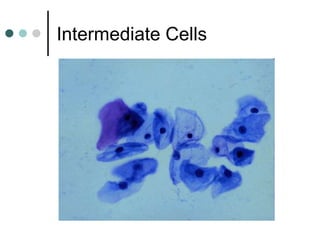 Intermediate Cells
 