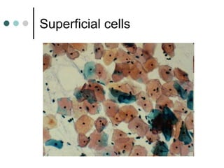 Superficial cells
 