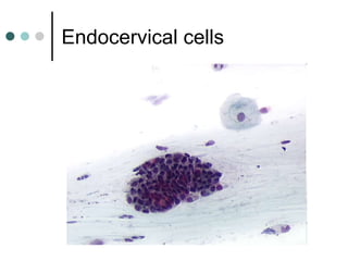 Endocervical cells
 