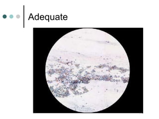 Adequate
 
