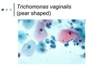 Trichomonas vaginalis
(pear shaped)
 