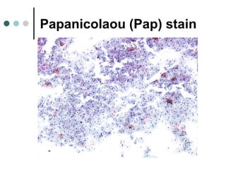 Papanicolaou (Pap) stain
 