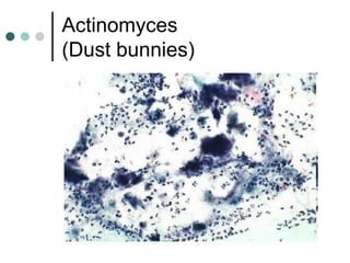 Actinomyces
(Dust bunnies)
 