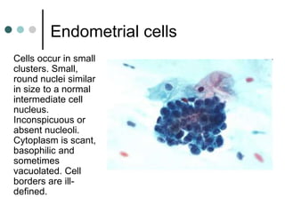 Endometrial cells
Cells occur in small
clusters. Small,
round nuclei similar
in size to a normal
intermediate cell
nucleus.
Inconspicuous or
absent nucleoli.
Cytoplasm is scant,
basophilic and
sometimes
vacuolated. Cell
borders are ill-
defined.
 