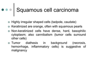 Squamous cell carcinoma
 Highly irregular shaped cells (tadpole, caudate)
 Keratinized are orange, often with squamous pearls
 Non-keratinized cells have dense, hard, basophilic
cytoplasm; also cannibalism (tumor cells surround
other cells)
 Tumor diathesis in background (necrosis,
hemorrhage, inflammatory cells) is suggestive of
malignancy
 