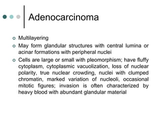 Adenocarcinoma
 Multilayering
 May form glandular structures with central lumina or
acinar formations with peripheral nuclei
 Cells are large or small with pleomorphism; have fluffy
cytoplasm, cytoplasmic vacuolization, loss of nuclear
polarity, true nuclear crowding, nuclei with clumped
chromatin, marked variation of nucleoli, occasional
mitotic figures; invasion is often characterized by
heavy blood with abundant glandular material
 