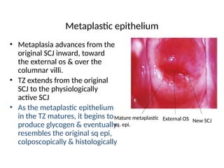 cervix anatomy and its clinical implication.pptx