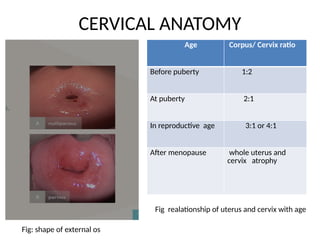 Normal Cervix Position Chart cervix anatomy and its clinical implication.pptx