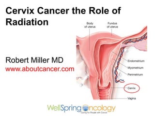 Robert Miller MD
www.aboutcancer.com
Cervix Cancer the Role of
Radiation
 