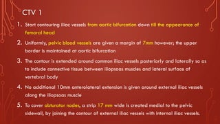CTV 1
1. Start contouring iliac vessels from aortic bifurcation down till the appearance of
femoral head
2. Uniformly, pelvic blood vessels are given a margin of 7mm however; the upper
border is maintained at aortic bifurcation
3. The contour is extended around common iliac vessels posteriorly and laterally so as
to include connective tissue between iliopsoas muscles and lateral surface of
vertebral body
4. No additional 10mm anterolateral extension is given around external iliac vessels
along the iliopsoas muscle
5. To cover obturator nodes, a strip 17 mm wide is created medial to the pelvic
sidewall, by joining the contour of external iliac vessels with internal iliac vessels.
 