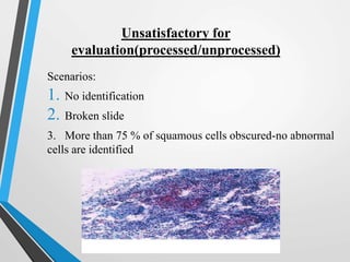 Unsatisfactory for
evaluation(processed/unprocessed)
Scenarios:
1. No identification
2. Broken slide
3. More than 75 % of squamous cells obscured-no abnormal
cells are identified
 