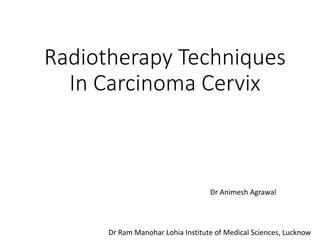 Radiotherapy Techniques
In Carcinoma Cervix
Dr Animesh Agrawal
Dr Ram Manohar Lohia Institute of Medical Sciences, Lucknow
 