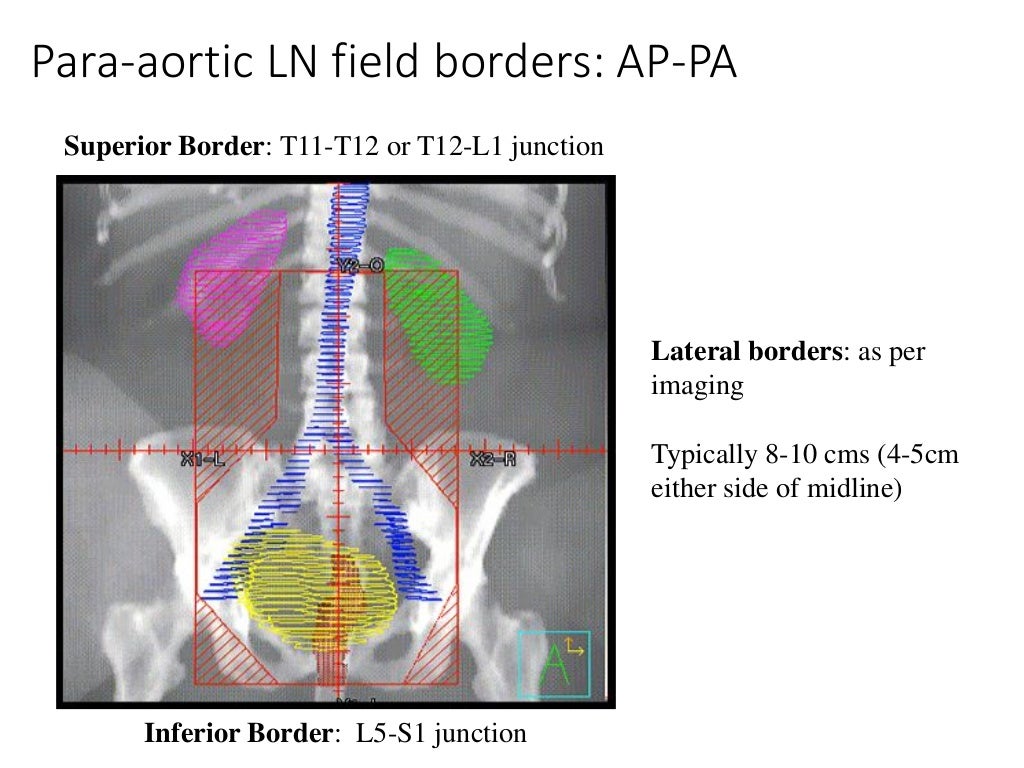 Cervix External Beam Radiotherapy techniques