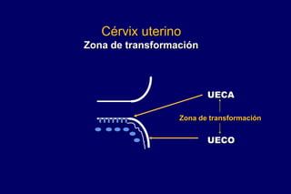 Cérvix uterino
Zona de transformación
UECO
UECA
Zona de transformación
 
